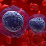 Tatiana Schlossberg's Death Highlights Urgent Acute Myeloid Leukemia Symptoms