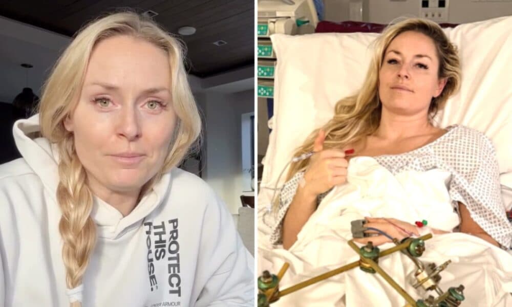 Lindsey Vonn Opens Up About Challenges After Winter Olympics Crash