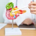 Spanish Lab's Breakthrough Erases Pancreatic Tumors in Mice, Raising Hope