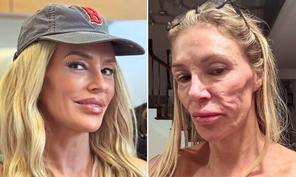 Brandi Glanville Unveils Stunning New Look Amid Ongoing Health Challenges