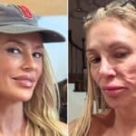 Brandi Glanville Unveils Stunning New Look Amid Ongoing Health Challenges